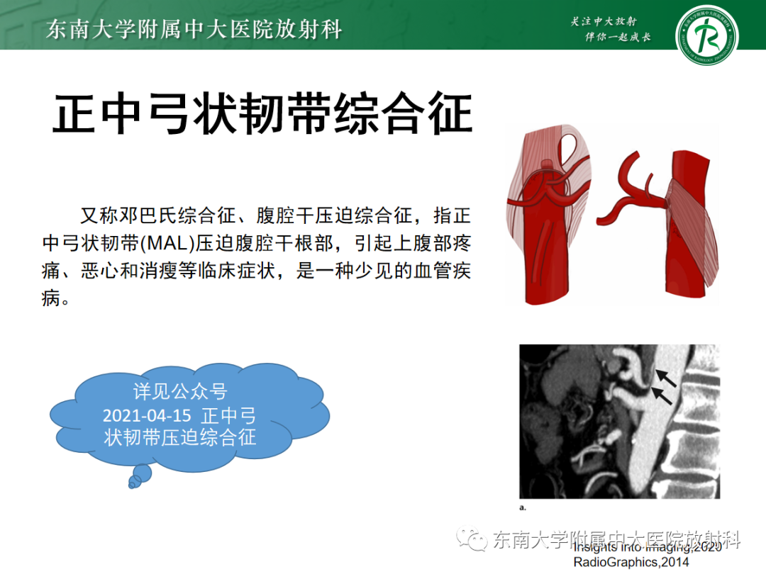 影像PPT - 【PPT】膈肌相关病变-31