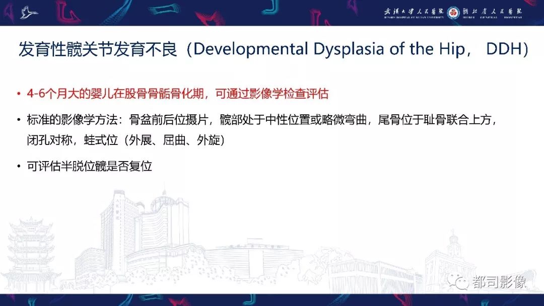 影像PPT - 【PPT】儿童、青少年髋部和下肢异常影像学诊断-9