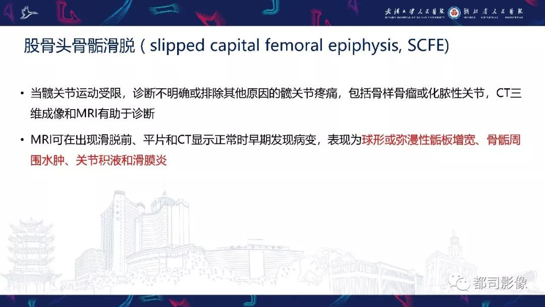 影像PPT - 【PPT】儿童、青少年髋部和下肢异常影像学诊断-20