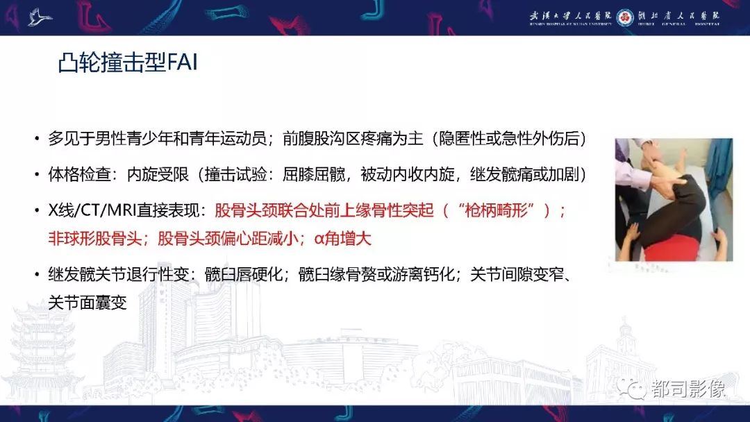 影像PPT - 【PPT】儿童、青少年髋部和下肢异常影像学诊断-27