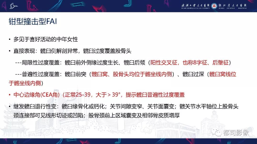 影像PPT - 【PPT】儿童、青少年髋部和下肢异常影像学诊断-30