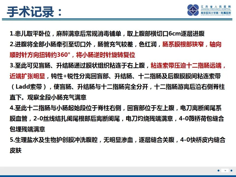 影像PPT - 【PPT】先天性肠旋转不良伴中肠扭转-15
