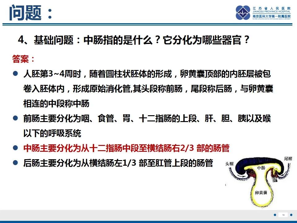 影像PPT - 【PPT】先天性肠旋转不良伴中肠扭转-14