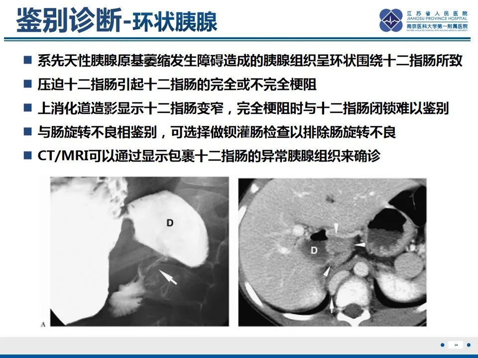 影像PPT - 【PPT】先天性肠旋转不良伴中肠扭转-35