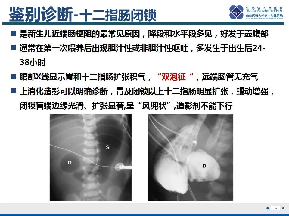 影像PPT - 【PPT】先天性肠旋转不良伴中肠扭转-34