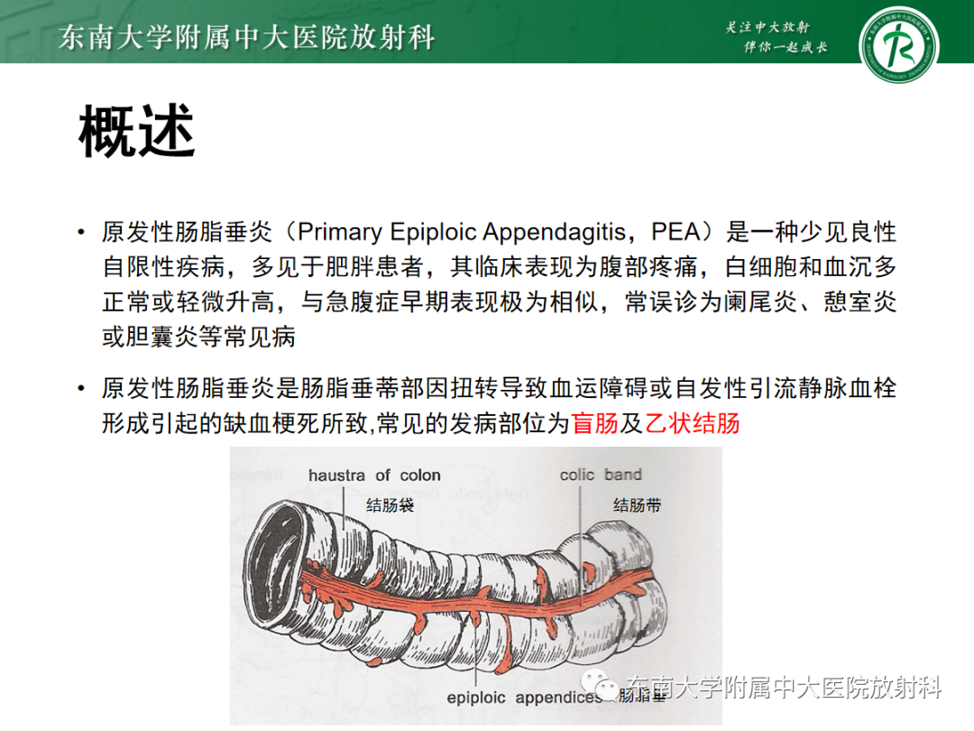 影像PPT - 【PPT】原发性肠脂垂炎-4
