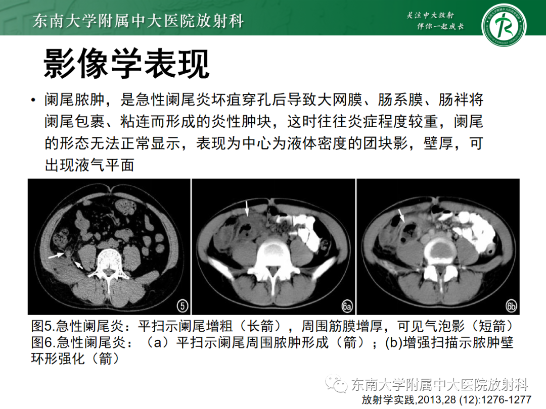 影像PPT - 【PPT】原发性肠脂垂炎-22