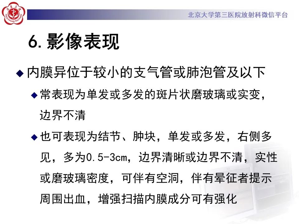 影像PPT - 【PPT】肺子宫内膜异位症-23