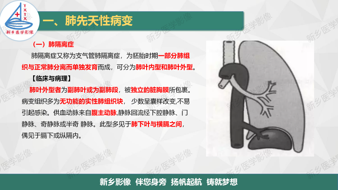 影像PPT - 【PPT】医学影像诊断学教材解读—肺部病变-4