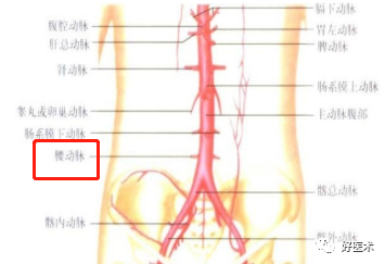 影像PPT - 血管解剖、起止点高清图-14 影像PPT - 血管解剖、起止点高清图-14