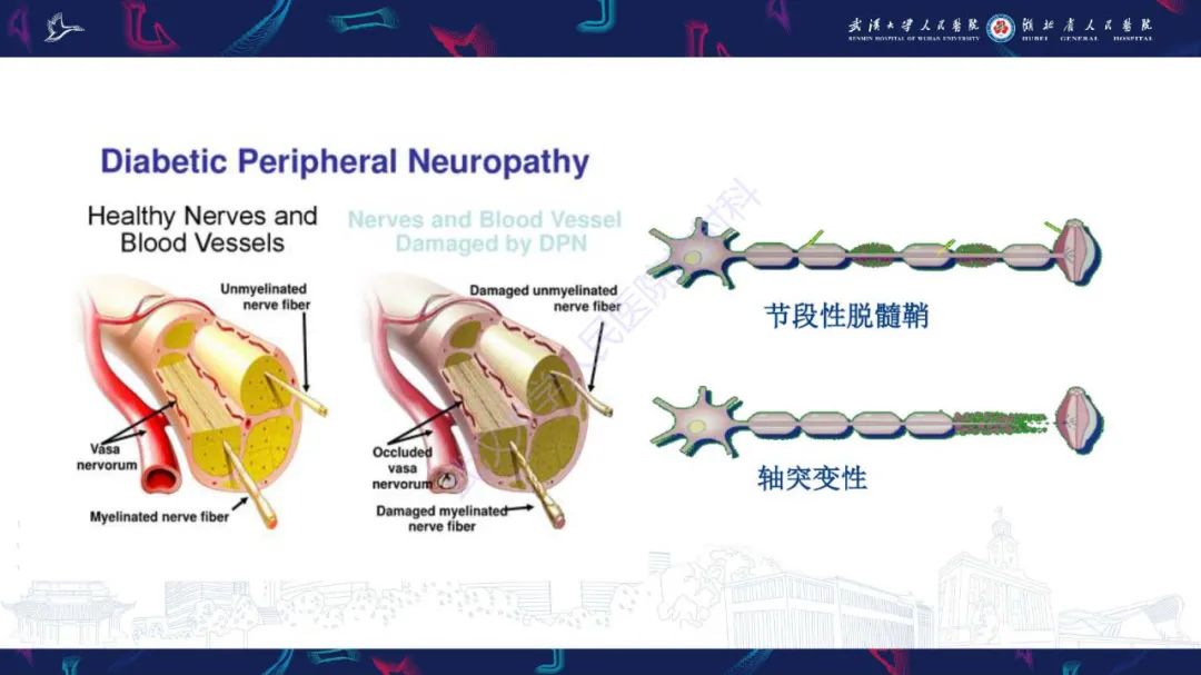影像PPT - 【PPT】糖尿病足影像诊断-9