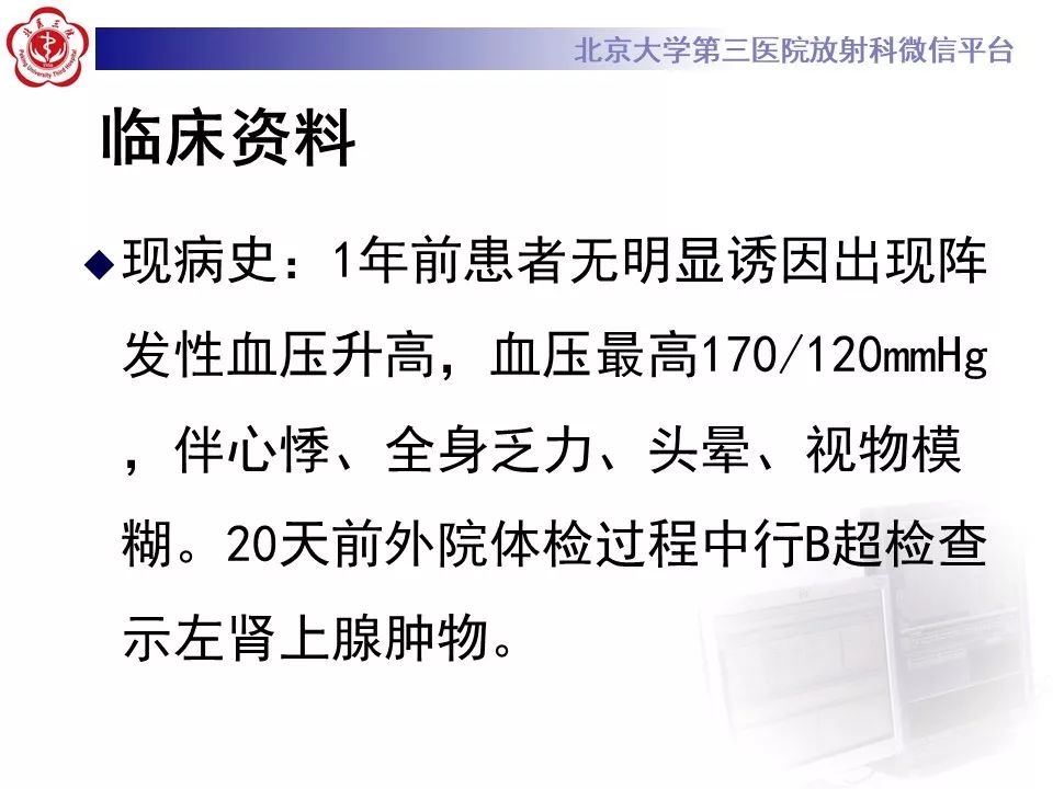 影像PPT - 【PPT】肾上腺髓样脂肪瘤-3