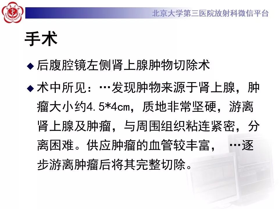 影像PPT - 【PPT】肾上腺髓样脂肪瘤-11