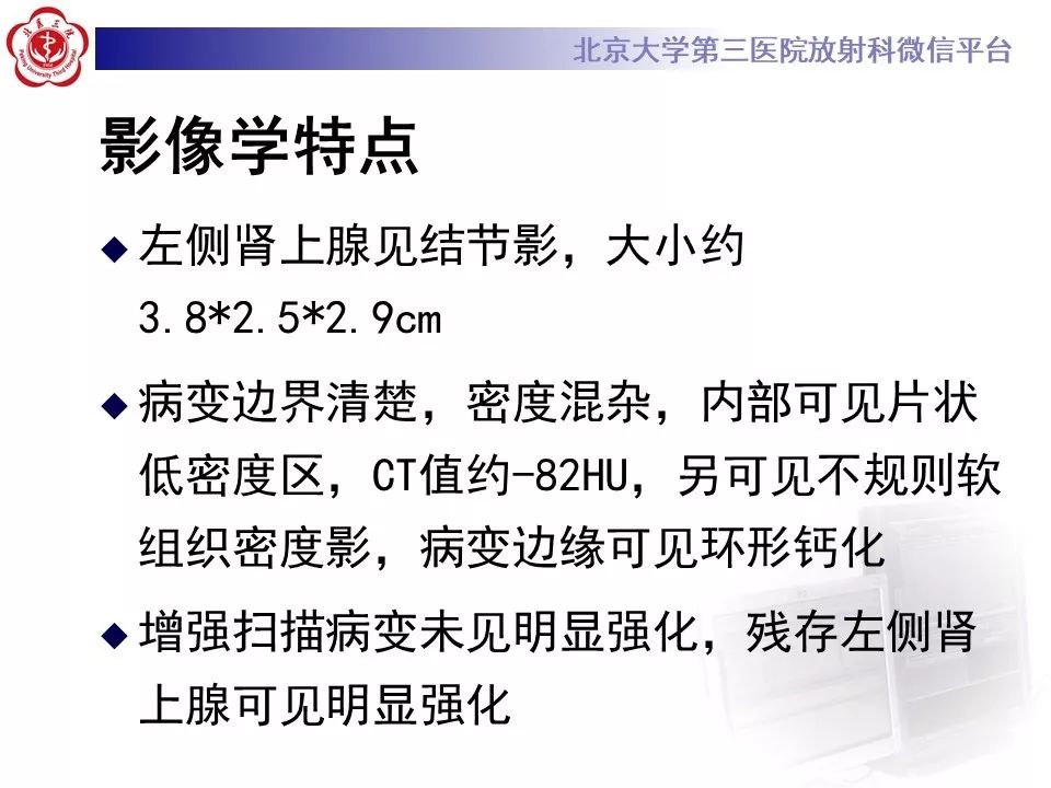 影像PPT - 【PPT】肾上腺髓样脂肪瘤-10