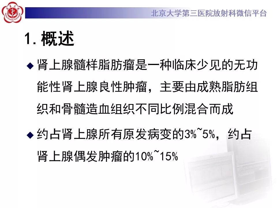 影像PPT - 【PPT】肾上腺髓样脂肪瘤-15