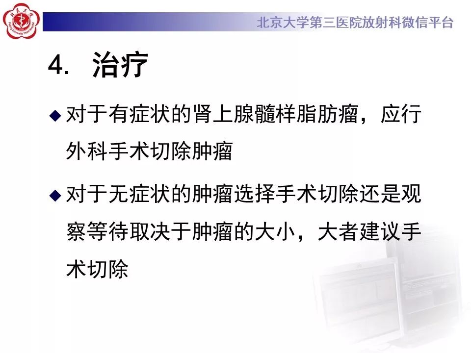 影像PPT - 【PPT】肾上腺髓样脂肪瘤-33