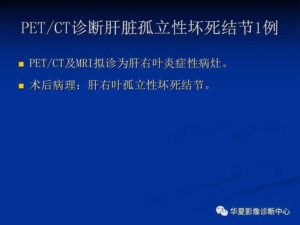 影像PPT - 【PPT】孤立性肝脏坏死结节的影像学表现-23
