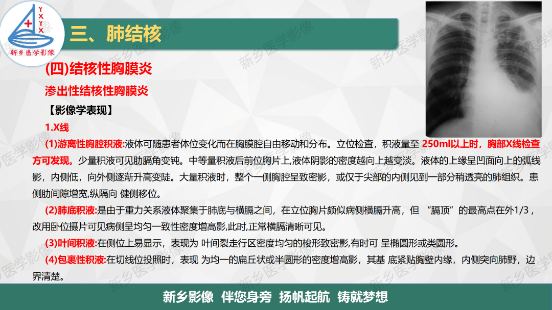 影像PPT - 【PPT】医学影像诊断学教材解读—肺部病变3-23