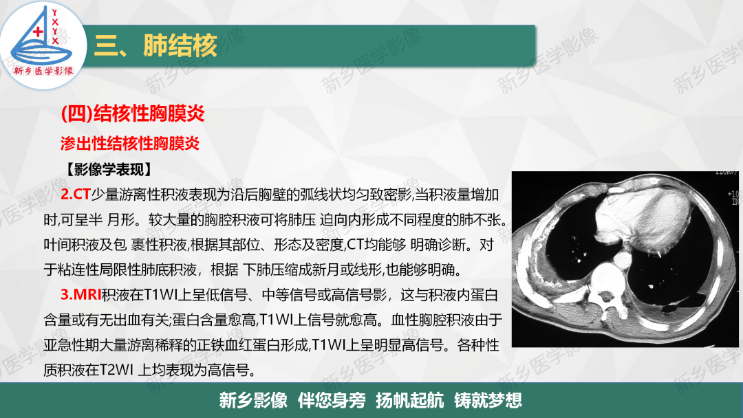 影像PPT - 【PPT】医学影像诊断学教材解读—肺部病变3-24