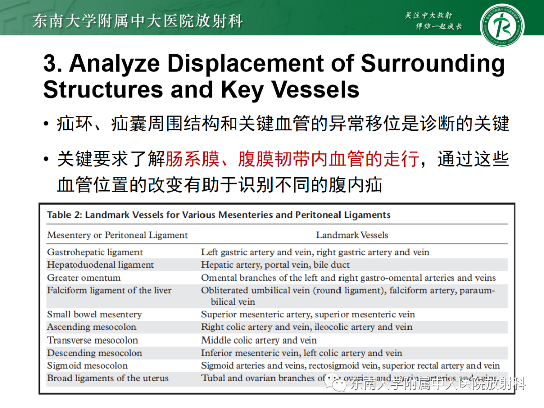 影像PPT - 【PPT】绞窄性小肠梗阻不可忽视的病因——腹内疝-10