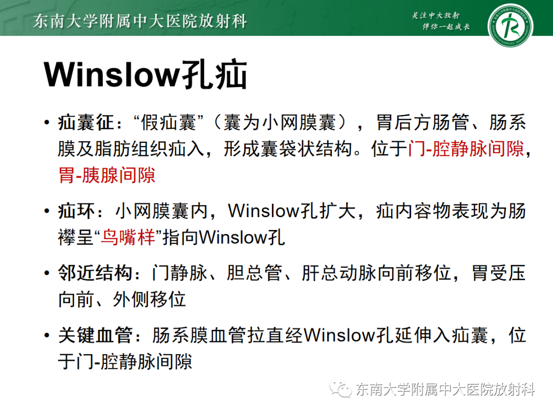 影像PPT - 【PPT】绞窄性小肠梗阻不可忽视的病因——腹内疝-24