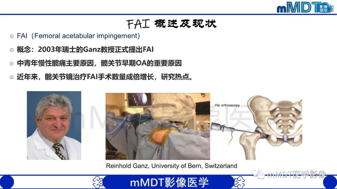 影像PPT - 【PPT】股骨髋臼撞击症影像学改变-3 影像PPT - 【PPT】股骨髋臼撞击症影像学改变-3