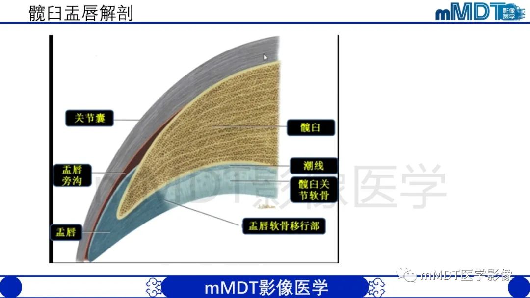 影像PPT - 【PPT】股骨髋臼撞击症影像学改变-6 影像PPT - 【PPT】股骨髋臼撞击症影像学改变-6