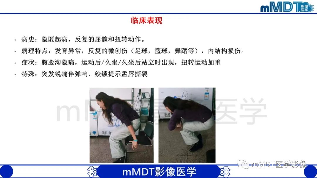 影像PPT - 【PPT】股骨髋臼撞击症影像学改变-4 影像PPT - 【PPT】股骨髋臼撞击症影像学改变-4