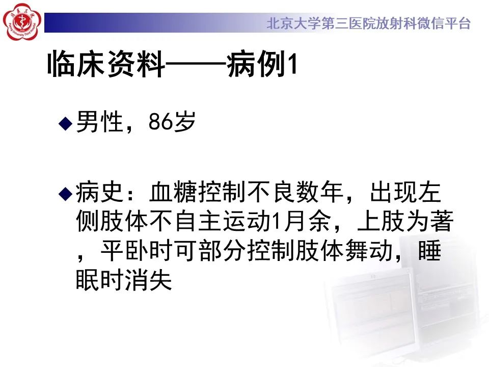 影像PPT - 【PPT】非酮症高血糖性偏侧舞蹈症-2