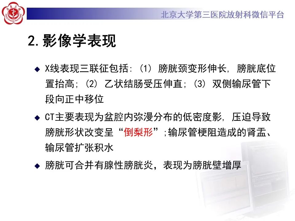 影像PPT - 【PPT】盆腔脂肪增多症-11