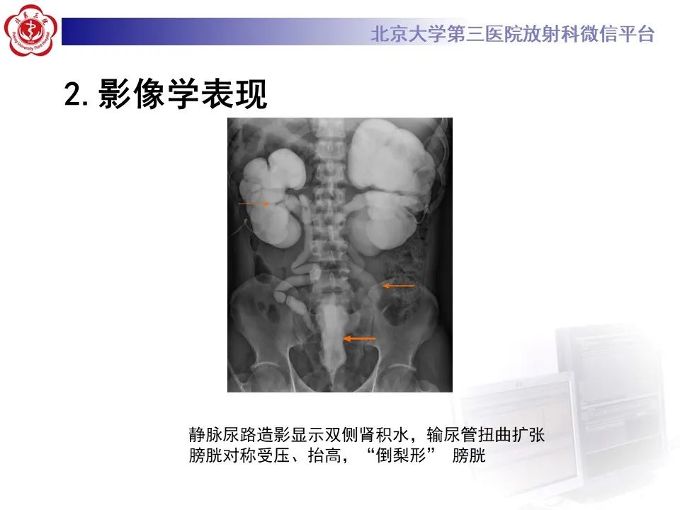 影像PPT - 【PPT】盆腔脂肪增多症-13