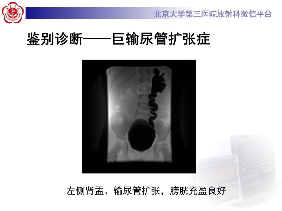 影像PPT - 【PPT】盆腔脂肪增多症-25