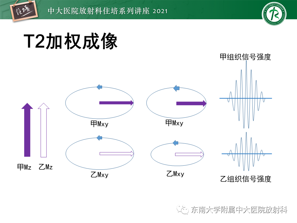 影像PPT - 【PPT】磁共振加权成像的实现-18