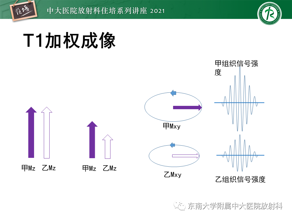 影像PPT - 【PPT】磁共振加权成像的实现-20
