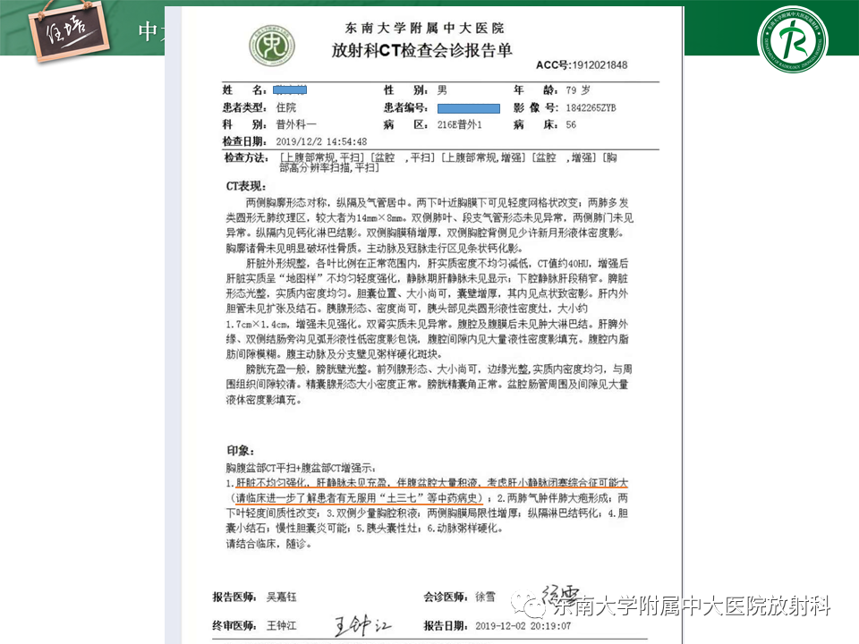 影像PPT - 【PPT】肝窦阻塞综合征-4