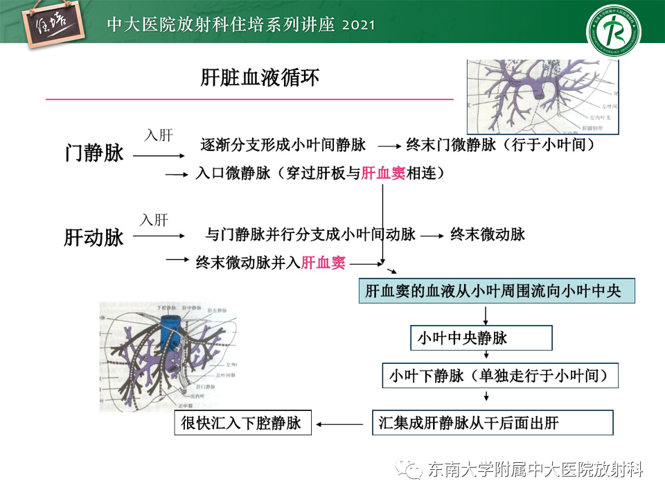 影像PPT - 【PPT】肝窦阻塞综合征-12