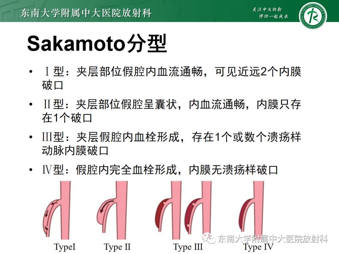 影像PPT - 【PPT】肠系膜上动脉夹层-10