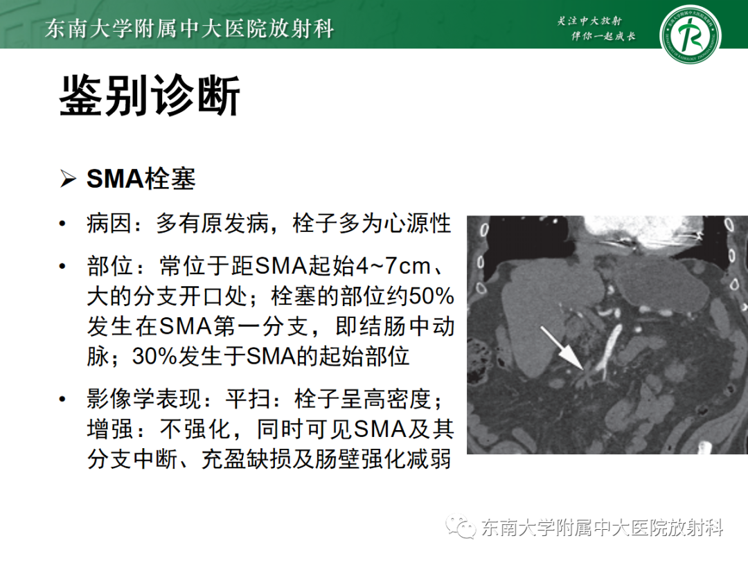 影像PPT - 【PPT】肠系膜上动脉夹层-12