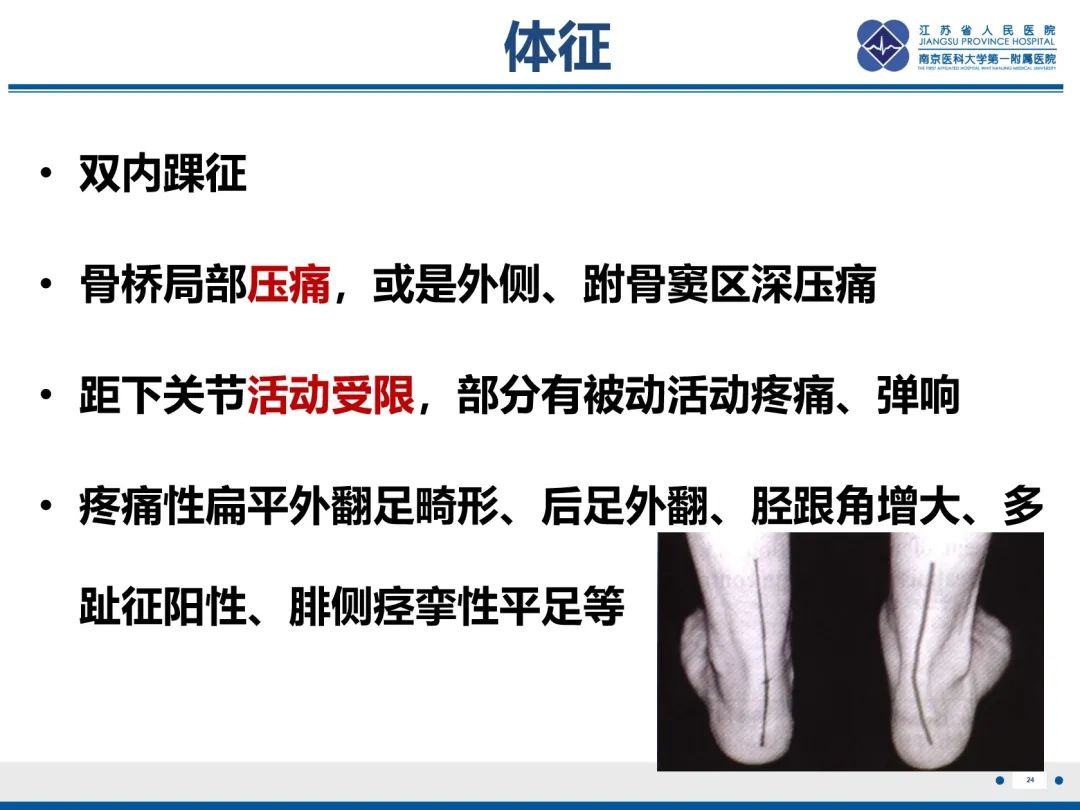 影像PPT - 【PPT】跟骨距骨桥-25