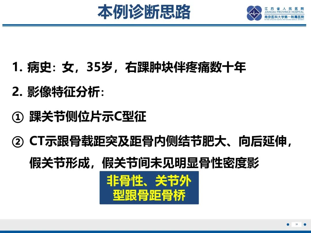 影像PPT - 【PPT】跟骨距骨桥-32