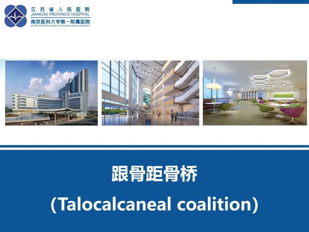 影像PPT - 【PPT】跟骨距骨桥-40