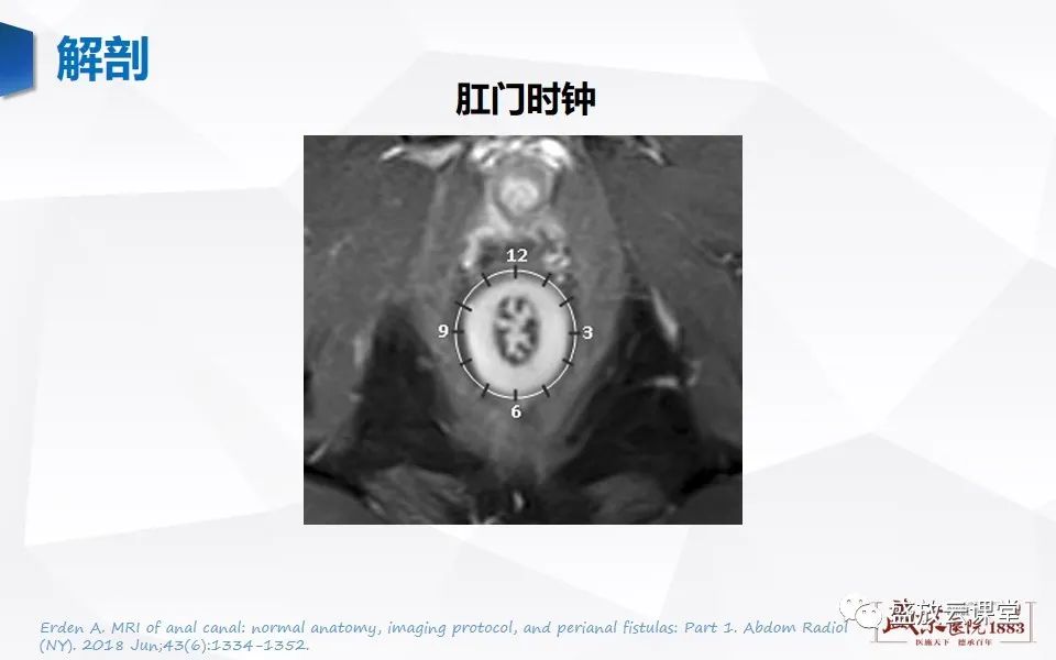 影像PPT - 【PPT】肛瘘的MRI诊断-16