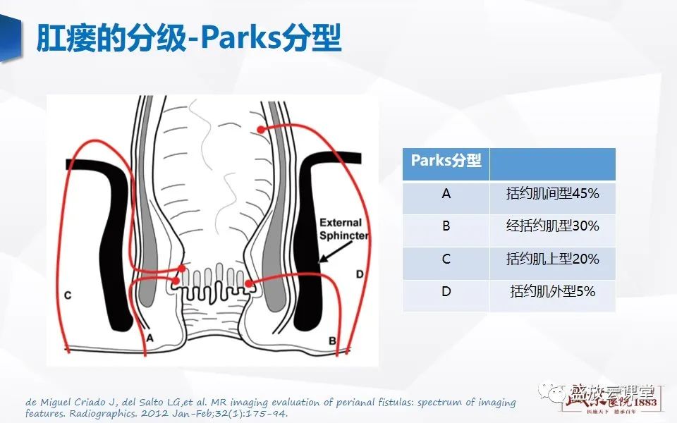 影像PPT - 【PPT】肛瘘的MRI诊断-21