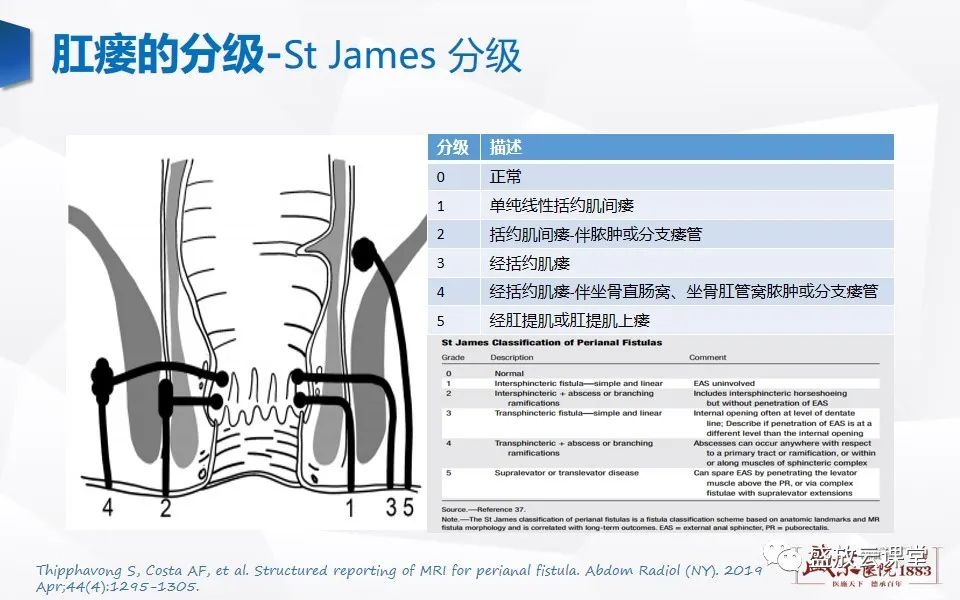 影像PPT - 【PPT】肛瘘的MRI诊断-22
