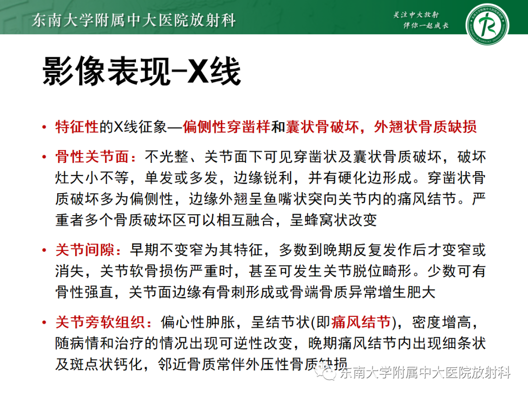 影像PPT - 【PPT】痛风性关节炎——脊柱痛风-8 影像PPT - 【PPT】痛风性关节炎——脊柱痛风-8