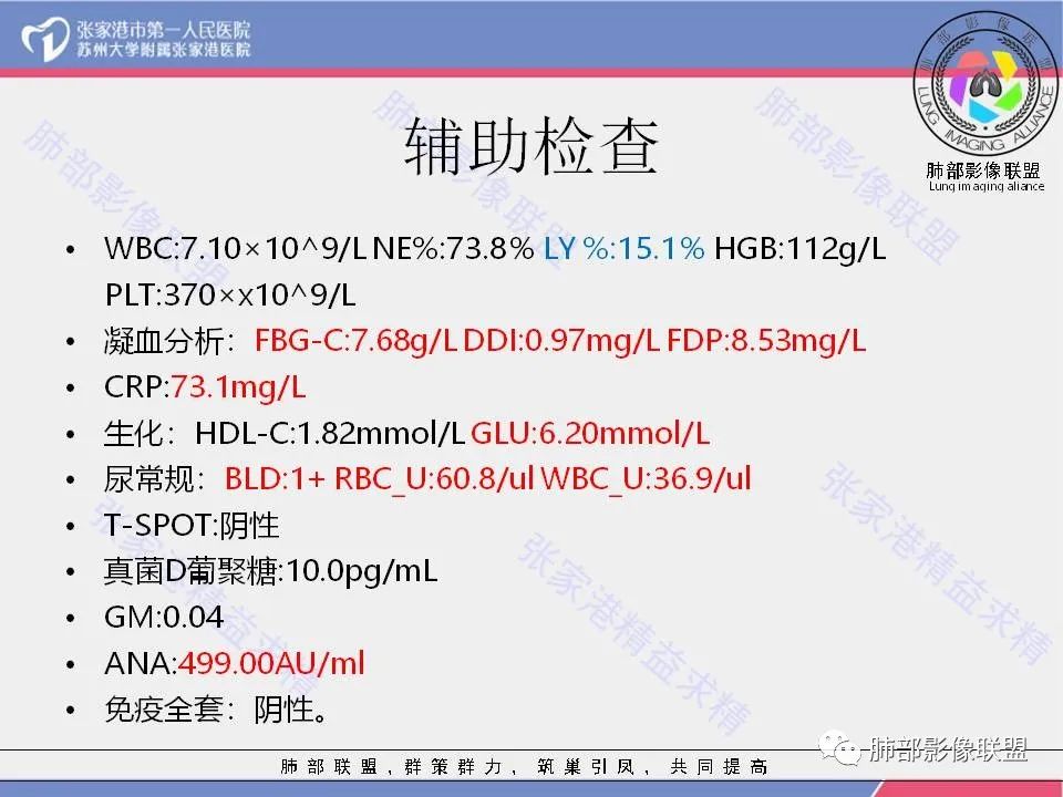 影像PPT - 【病例】隐源性机化性肺炎1例CT影像-4 影像PPT - 【病例】隐源性机化性肺炎1例CT影像-4