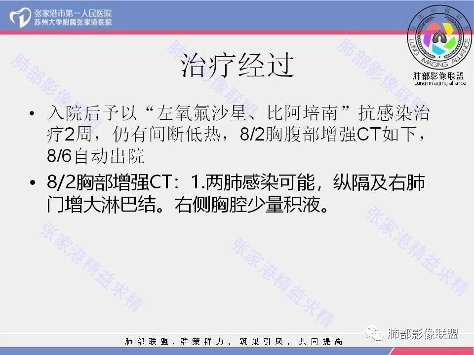 影像PPT - 【病例】隐源性机化性肺炎1例CT影像-5 影像PPT - 【病例】隐源性机化性肺炎1例CT影像-5