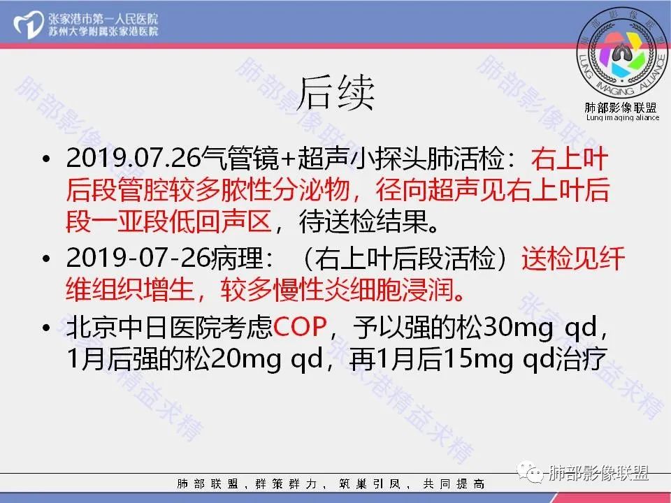 影像PPT - 【病例】隐源性机化性肺炎1例CT影像-20 影像PPT - 【病例】隐源性机化性肺炎1例CT影像-20
