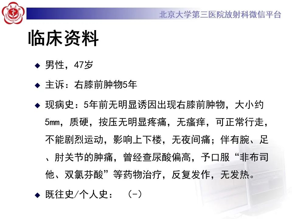 影像PPT - 【PPT】痛风性膝关节炎-2