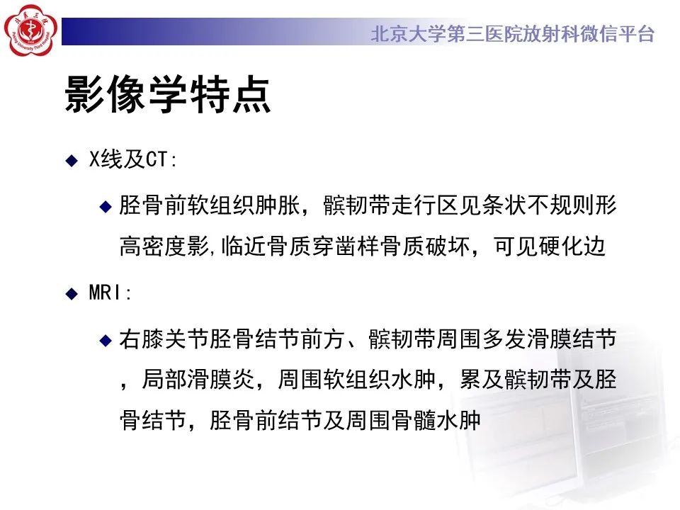 影像PPT - 【PPT】痛风性膝关节炎-7